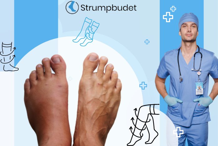 Stödstrumpor biverkningar som visar svullna fötter och en läkare
